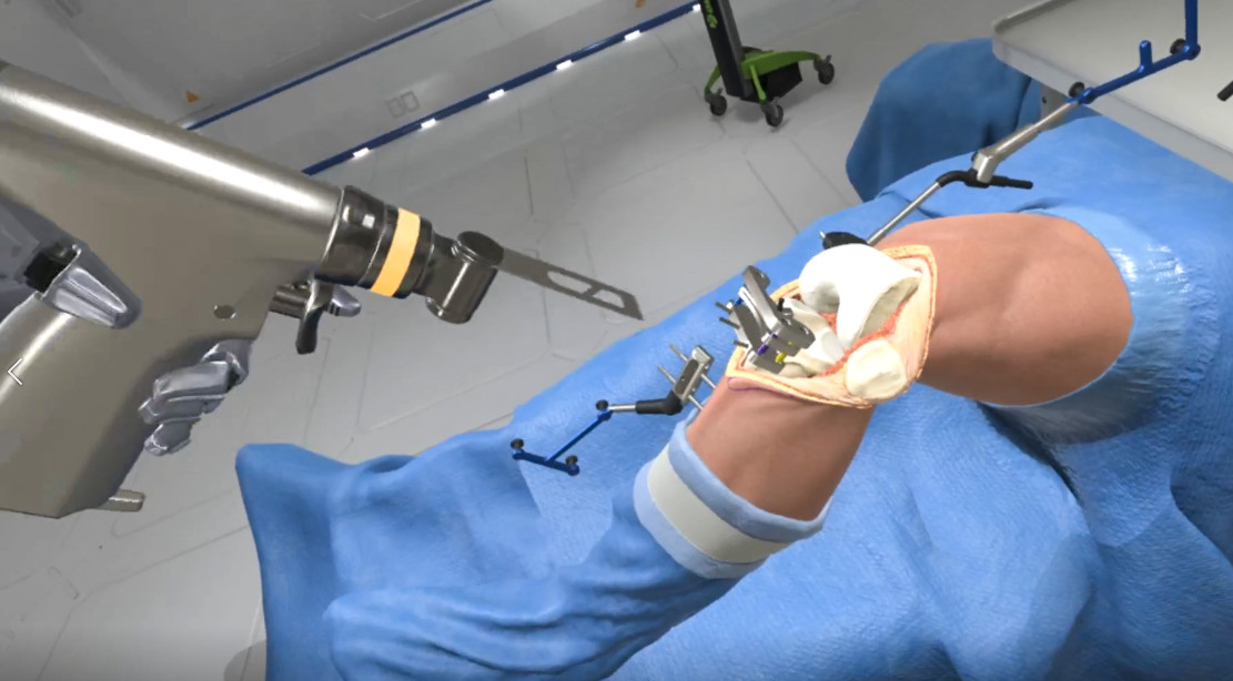 Ghost Productions: Wraith VR Total Knee Replacement Surgery Simulation screenshot 5