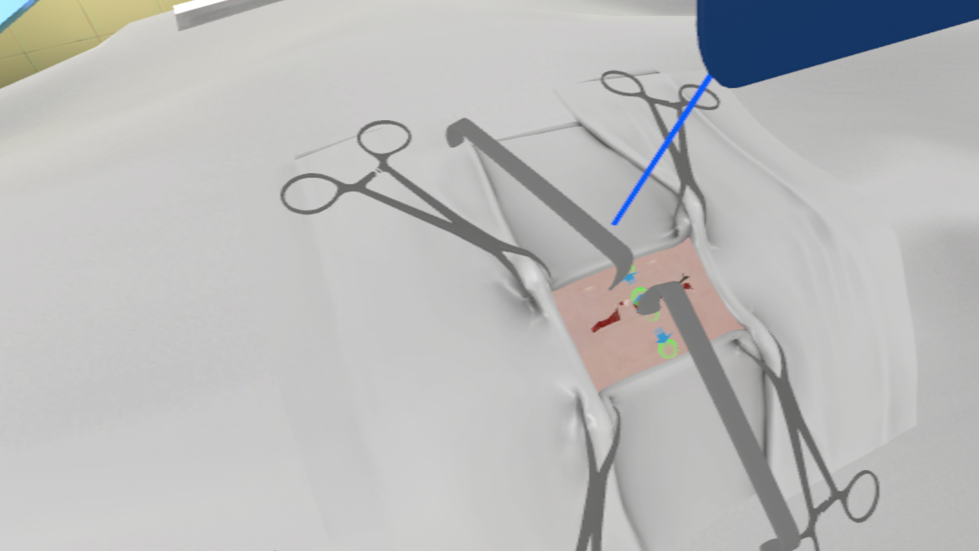 PST VR (Primary Surgical Treatment) screenshot 2