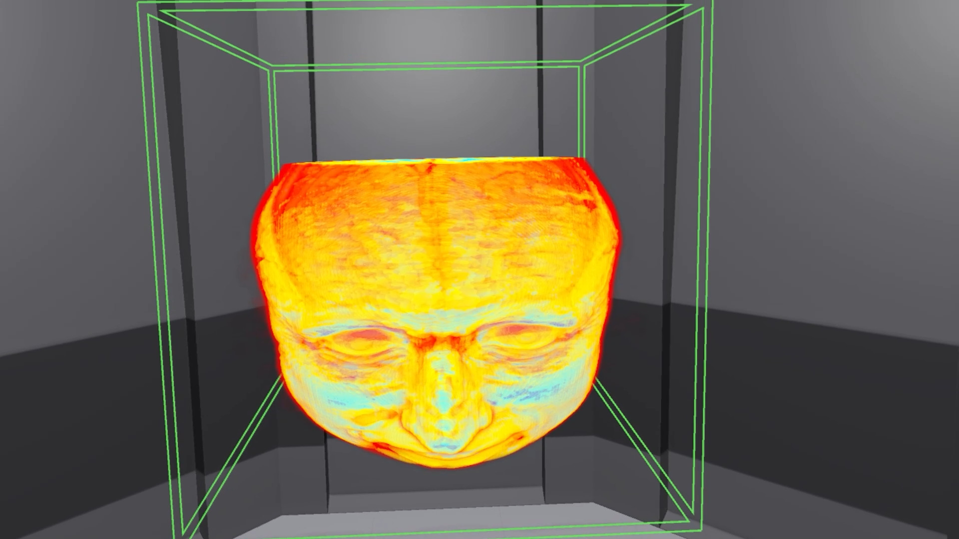MedicalImagingVR screenshot 2