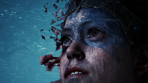 Accolades Trailer trailer thumbnail