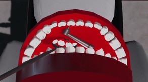 Dental Madness: Cavity Mania trailer 2 trailer thumbnail