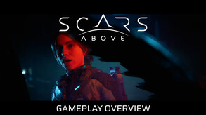 101 Scars Above trailer thumbnail