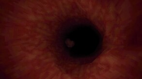 Revenge Of The Colon - Teaser Trailer trailer thumbnail