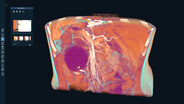 XR Medical Imaging trailer thumbnail