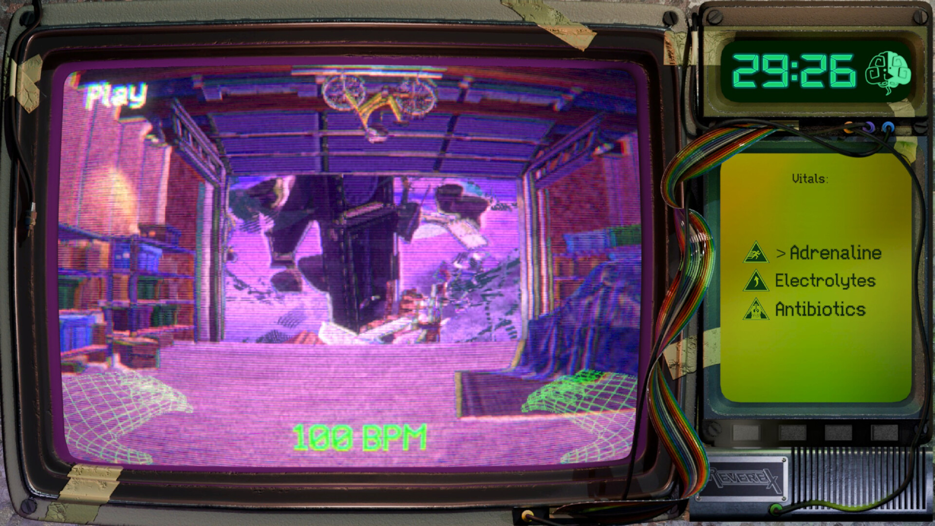 REVEREX: DX screenshot 1